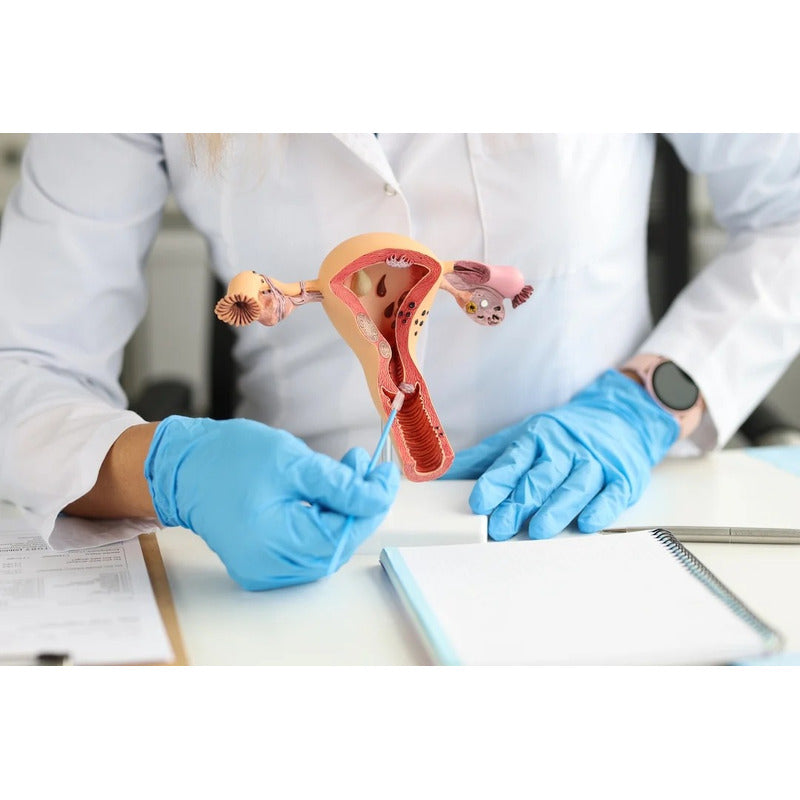 Cepillo Citologico Endocervical 100 Pzas Papanicolau